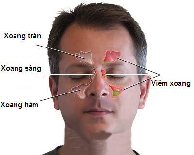 nguyen-nhan-dan-den-viem-xoang